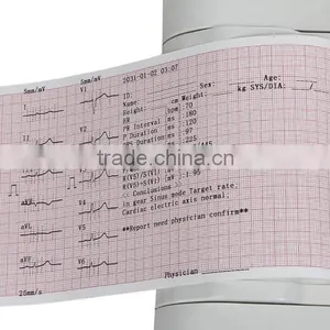 Hot Sale Portable Digital 6-channel Software Electrocardiograph 7 Inch Color Touch Screen ECG Machine EKG Machine EKG-923-Shelly thumbnail-6