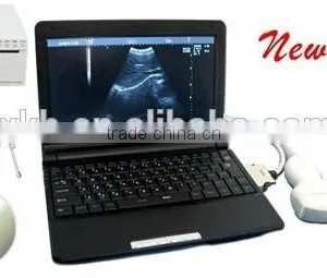 Hot Cheapest Hospital Clinic Diagnosis Laptop Ultrasound Scanner/Machine With Probe/Transducer and Printer-RUS-9000F thumbnail-1
