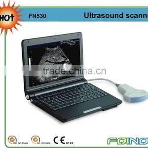 FN530 HOT Selling Full Digital Laptop Ultrasound Equipment thumbnail-1