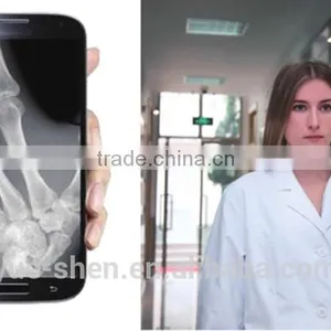 For All Kinds of X-ray Machine Flat Panel Digital X-ray System thumbnail-3