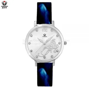 XINBOQIN Supplier Your LOGO Custom Ladies Brands Casual Quartz Waterproof Japan Movement PC21 Quartz Acetate Watch thumbnail-4