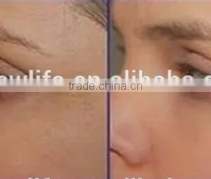 Dispel Chloasma NL-HS201 2016concentrator System/oxygen Jet Facial Machines/water Oxygen Machine Skin Analysis thumbnail-6