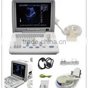 Good Price Full Digital Portable Ultrasound Scanner RUS-6000D With Linear Transvaginal Convex Microconvex Probe thumbnail-2