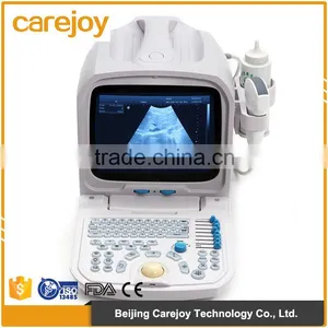 Widely Used 3D Full Digital Portable Ultrasound Scanner Suitable for the Diagnosis of Abdomen, Cardiac, Gynecology, Obstetrics thumbnail-1