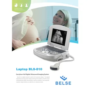 All Digital Ultrasonic Diagnosis SystemPortable Digital Acoustic Diagnostic Scanner for Human in Hospital thumbnail-1