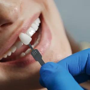 Quality Implant Crown and Bridge Manufacturers & Exporter - Buy Total Implant PFM Bridge China Dental Lab From China Manufacturer. thumbnail-5