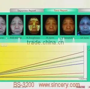 Portable Facial Skin Scanner Analyzer 3D Facial Skin Analysis thumbnail-2