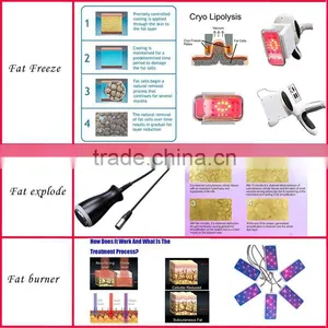Multifunctional Vacuum Rollerslimming Machine Kriolipoliza Liposukce Fat Removal Maquina thumbnail-6