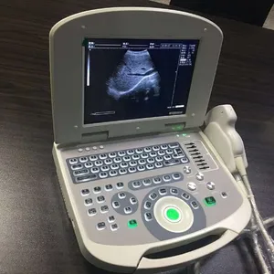 All Digital Ultrasonic Diagnosis SystemPortable Digital Acoustic Diagnostic Scanner for Human in Hospital thumbnail-2