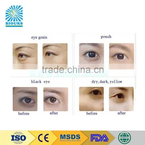 Skin Care Products Crystal Moisturzier Remove Black Bag Eye Mask Patch thumbnail-2