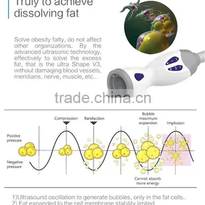 HIFU Ultrashape Body New 300W Slimming Technology Machine 7MHZ thumbnail-3