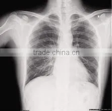 Konida Automatic Fuji Dry Film Laser Medical Hot Sex X-ray Film thumbnail-1