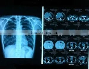 Agfa Film Agfa Dry Films Agfa X-ray Film thumbnail-3