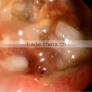 MQ Brand Good Quality Multi-function Medical pa Film thumbnail-5