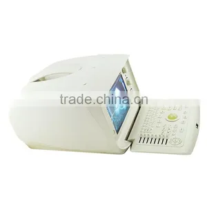 High Sensitivity Trolley Style Digital Portable Ultrasound Scanner With 2 Probe Connector thumbnail-2
