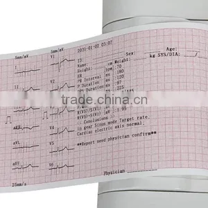 China Cheap Price Portable Six-channel Software Electrocardiograph Color Touch Screen 6 Channel Portable Ecg Machine thumbnail-5