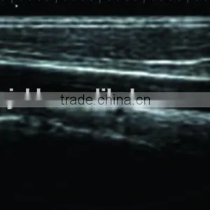 Notebook Ultrasound Scanner RUS-9000F With 3.5Mhz Convex Probe and 7.5Mhz Linear Probe Diagnosis Machine thumbnail-3