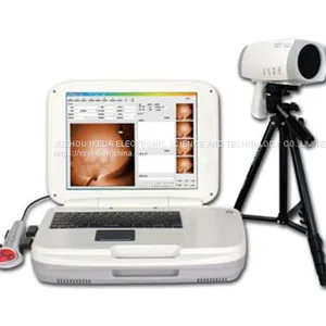 Full HD Infrared Mammary Gland Examination System thumbnail-1