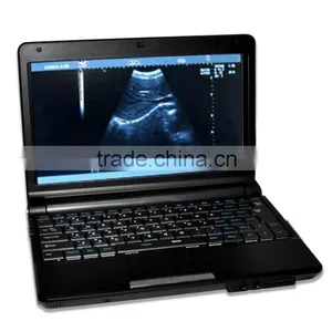 Low Factory Price!CE Approved Laptop Ultrasound Scanner/Ultrasound Machine RUS-9000F With 6.5Mhz Transvaginal Probe thumbnail-1