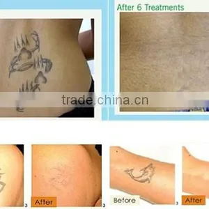 D003 Professional Laser Tattoo Removel Machine / Tattoo Equipment thumbnail-6
