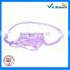 Medical Survey Biological Dentall Pathology Prepared Slides thumbnail-1