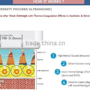 Waist Shaping Portable HIFU Beauty Machine /China HIFU Factory In 5.0-25mm Quality HIFU Technology Deepth 4.5MM Dermis Effective HIFU Results 0.2-3.0J thumbnail-4