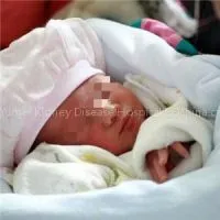 Children Lupus Nephritis Causes thumbnail-1