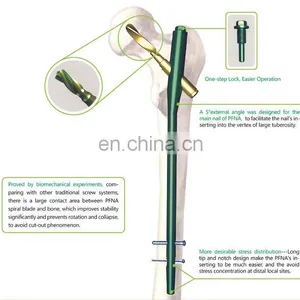 PFNA Nails thumbnail-6