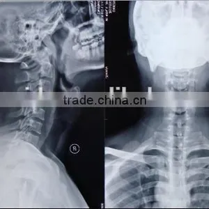 Medical Dry Films,medical Films.fuji Dry Film thumbnail-1