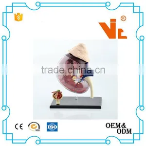V-HM05 4D MASTER Human Kidney Structure Model thumbnail-3