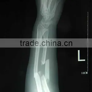 Fuji Medical X-ray Film Made in China , Digital x Ray Film thumbnail-1