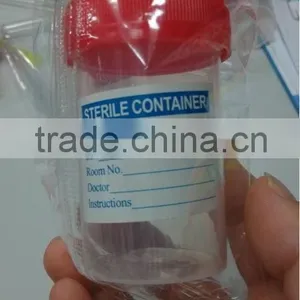 Sterile Urine Collection Cup Hospital Urine Container thumbnail-2