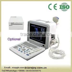 Portable Ultrasound Scanner With 3.5Mhz Probe Optional Video Thermal Recorder Linear Probe Transvaginal thumbnail-1