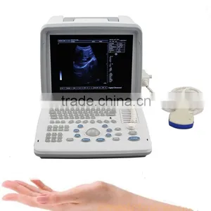OEM Supply 12 Inch Laptop Ultrasound Scanner Ultrasonic Machine B Ultrasound Scanner for Sale thumbnail-2