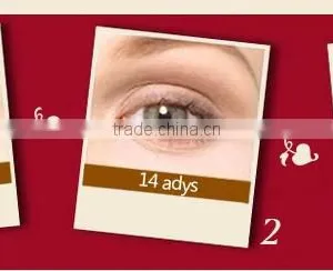 Portable Korea Hifu Beauty Eye Care Skin Whitening High Quality Low Price thumbnail-5