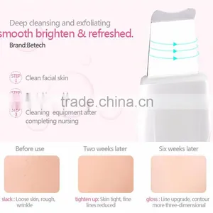 Ultrasonic Facial Skin Scrubber Beauty Instrument thumbnail-2