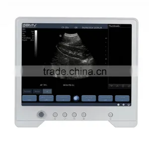 B&W Touch Screen Ultrasound Scanner/machine TS20 thumbnail-4
