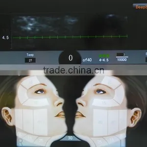 30000 Times High Intensity Focused Ultrasound HIFU Equipment thumbnail-2