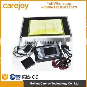 CE/ISO Approved Palm Ultrasound Machine Frequency 2.5MHZ-7.5MHZ thumbnail-1