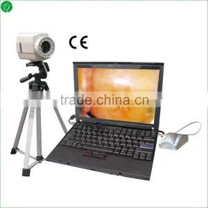 Digital Laptop Colposcope thumbnail-1