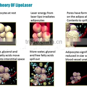 10 Paddles Ilipo Laser 650nm Wavelength Lipolaser Slimming Fat Removal Equipment For Salon Use thumbnail-3