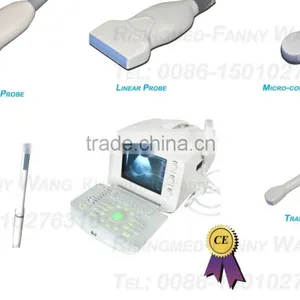 CE Approved Portable B-Mode Ultrasound Scanner With 3.5Mhz Multi-frequency Convex Probe RUS-6000A thumbnail-1
