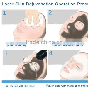 Easy Operation Laser Acne Removal Machine thumbnail-6