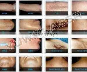 10.4 Inch Screen Amazing New Arrival Most Advanced 808nm Diode Laser 1-10HZ High Power /diode Laser Hair Removal Machine / Diode Laser 808 8.4 Inches thumbnail-6