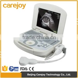 Factory Price Hospital Full Digital Portable Ultrasound Scanner Price thumbnail-1