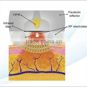 6 in 1 Lipo Ultrasonic Cavitation Machine , RF 940nm Vacuum rf Device thumbnail-5
