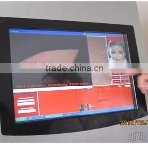 Latest Designed Portable Facial Real Analysis Portable Skin Scope Analyzer thumbnail-1