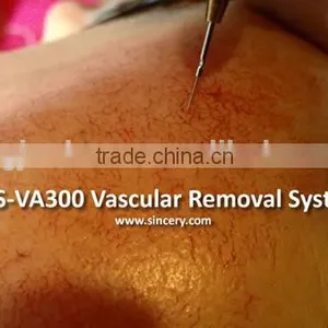 HF Spider Veins Removal Machine For Small Vessels Vascular Veins on Face, Ear Back, Forehea thumbnail-4