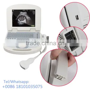 CE Approved Portable Ultrasound Scanner 96 Element USG Ultrasonography Diagnosis Machine thumbnail-1