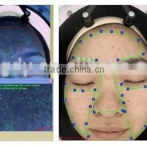 Langdy Facial Skin Analysis Machine Factory Direct Selling Price With CE thumbnail-4